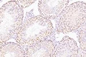 Immunohistochemistry (Paraffin-embedded Sections) (IHC (p)) image for anti-Non-SMC Condensin II Complex, Subunit G2 (NCAPG2) antibody (ABIN7074856)