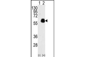 Western blot analysis of PXN(arrow) using rabbit polyclonal PXN Antibody  (ABIN390376 and ABIN2840778). (Paxillin 抗体  (AA 94-125))