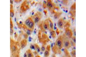 Used in DAB staining on fromalin fixed paraffin-embedded Liver tissue (Laminin alpha 5 抗体  (AA 3517-3718))