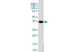 MEOX2 monoclonal antibody (M03), clone 6A5 Western Blot analysis of MEOX2 expression in HeLa .