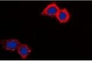 Immunofluorescent analysis of NHE8 staining in HepG2 cells. (NHE8 抗体  (C-Term))