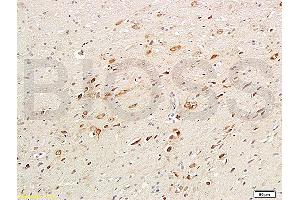 Formalin-fixed and paraffin embedded rat brain labeled with Anti-ChAT Polyclonal Antibody, Unconjugated (ABIN724070) 1:200followed by conjugation to the secondary antibody and DAB staining (Choline Acetyltransferase 抗体  (AA 101-200))