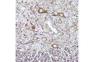 Immunohistochemistry (IHC) image for anti-Neurofilament, Light Polypeptide (NEFL) antibody (ABIN7268867)