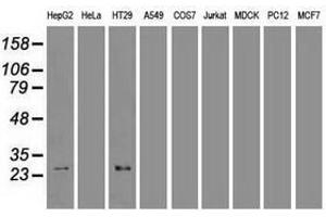 Image no. 1 for anti-Hematopoietically Expressed Homeobox (HHEX) (AA 100-270) antibody (ABIN1490800) (HHEX 抗体  (AA 100-270))