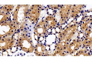 Detection of PRLR in Rat Kidney Tissue using Polyclonal Antibody to Prolactin Receptor (PRLR) (Prolactin Receptor 抗体  (AA 20-229))