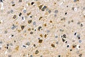 Immunohistochemistry (Paraffin-embedded Sections) (IHC (p)) image for anti-Solute Carrier Family 6 (Neutral Amino Acid Transporter), Member 15 (SLC6A15) antibody (ABIN7075681)