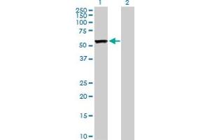 Western Blot analysis of CAP1 expression in transfected 293T cell line by CAP1 MaxPab polyclonal antibody. (CAP1 抗体  (AA 1-475))