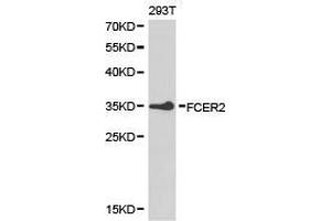 Western Blotting (WB) image for anti-Fc Fragment of IgE, Low Affinity II, Receptor For (CD23) (FCER2) antibody (ABIN1872669) (FCER2 抗体)