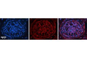 Rabbit Anti-TSPAN3 Antibody   Formalin Fixed Paraffin Embedded Tissue: Human Testis Tissue Observed Staining: Plasma membrane in spermatogonia and spermatocytes Primary Antibody Concentration: N/A Other Working Concentrations: 1:600 Secondary Antibody: Donkey anti-Rabbit-Cy3 Secondary Antibody Concentration: 1:200 Magnification: 20X Exposure Time: 0. (Tetraspanin 3 抗体  (Middle Region))
