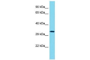 Host:  Rabbit  Target Name:  Vgll1  Sample Type:  Mouse Stomach lysates  Antibody Dilution:  1. (VGLL1 抗体  (C-Term))