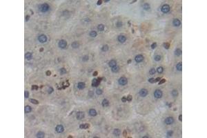 #VALUE! (Poliovirus Receptor 抗体  (AA 22-255))