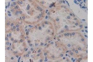 Detection of ABP1 in Human Kidney Tissue using Polyclonal Antibody to Amiloride Binding Protein 1 (ABP1) (DAO 抗体  (AA 347-466))