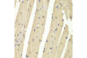 Immunohistochemistry of paraffin-embedded mouse heart using USP7 antibody at dilution of 1:200 (400x lens).