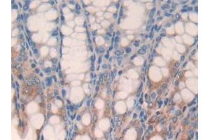 Immunohistochemistry (IHC) image for anti-Glypican 3 (GPC3) (AA 344-559) antibody (ABIN7442228)