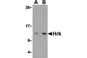 Western Blotting (WB) image for anti-Harakiri, BCL2 Interacting Protein (Contains Only BH3 Domain) (HRK) (Middle Region) antibody (ABIN1030949) (HRK 抗体  (Middle Region))