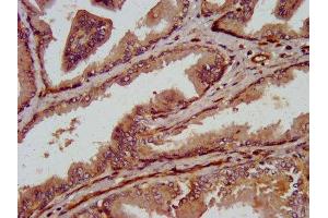 Immunohistochemistry (IHC) image for anti-Transient Receptor Potential Cation Channel, Subfamily V, Member 2 (TRPV2) (AA 1-117) antibody (ABIN7172879)