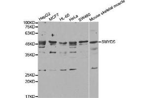Western Blotting (WB) image for anti-SMYD Family Member 5 (SMYD5) antibody (ABIN1882323) (SMYD5 抗体)