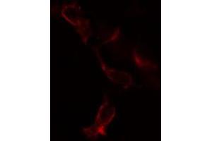 ABIN6269382 staining COLO205 cells by IF/ICC. (B-Cell Linker 抗体  (N-Term))
