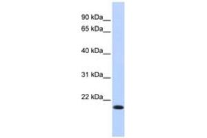 Image no. 1 for anti-Interferon Regulatory Factor 7 (IRF7) (AA 35-84) antibody (ABIN6742766) (IRF7 抗体  (AA 35-84))