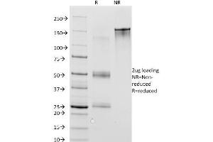 SDS-PAGE Analysis Purified MAGE-1 Mouse Monoclonal Antibody (MA454). (MAGEA1 抗体)