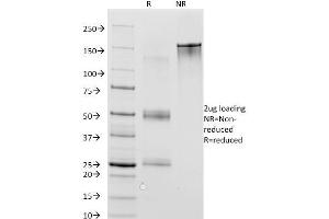 SDS-PAGE Analysis Purified MAGE-1 Mouse Monoclonal Antibody (MA454). (MAGEA1 抗体)