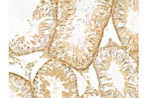 ABIN6260492 and ABIN6268884 at 1/100 staining Rat testis tissue by IHC-P. (CTNNA1 抗体  (C-Term))