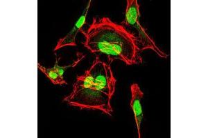 Immunofluorescence analysis of HeLa cells using CDK2 mouse mAb (green).
