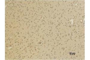 Immunohistochemistry (IHC) analysis of paraffin-embedded Rat Brain Tissue using GluR4 Polyclonal Antibody. (GRIA4 抗体)