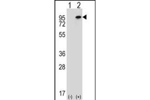 Western blot analysis of WHSC1L1 (arrow) using rabbit polyclonal WHSC1L1 Antibody (N-term) (ABIN656685 and ABIN2845923). (WHSC1L1 抗体  (N-Term))