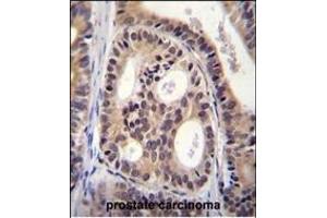 Immunohistochemistry (Paraffin-embedded Sections) (IHC (p)) image for anti-Sperm Antigen with Calponin Homology and Coiled-Coil Domains 1-Like (SPECC1L) (AA 108-136), (N-Term) antibody (ABIN656040)