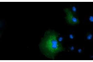 Anti-IVD mouse monoclonal antibody (ABIN2453188) immunofluorescent staining of COS7 cells transiently transfected by pCMV6-ENTRY IVD (RC201077). (IVD 抗体)