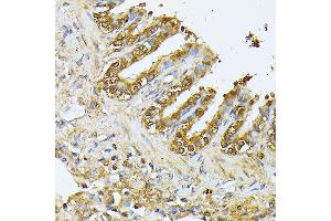 Immunohistochemistry of paraffin-embedded Rat lung using Parkin antibody  at dilution of 1:100 (40x lens).