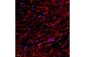 Immunofluorescence (Paraffin-embedded Sections) (IF (p)) image for anti-SET and MYND Domain Containing 2a (SMYD2A) antibody (ABIN7075581)