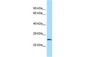 Host:  Rabbit  Target Name:  Lrrc14  Sample Type:  Mouse Testis lysates  Antibody Dilution:  1. (LRRC14 抗体  (C-Term))