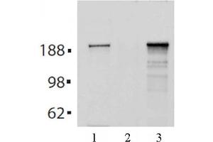 Tes2 mAb (Clone 21F11) tested by Immunoprecipitation. (TET2 抗体  (AA 1-300))