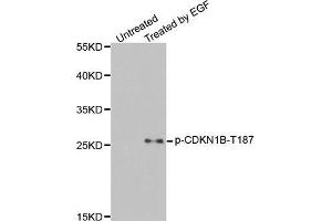 Western Blotting (WB) image for anti-Cyclin-Dependent Kinase Inhibitor 1B (p27, Kip1) (CDKN1B) (pThr187) antibody (ABIN1870060) (CDKN1B 抗体  (pThr187))