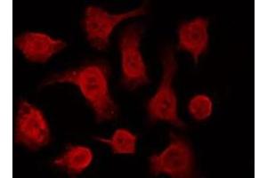 ABIN6266612 staining HeLa by IF/ICC. (p63 抗体  (C-Term))