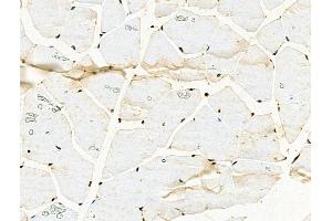 Phospho-TOP2A (Thr1343) Antibody at 1/100 staining Mouse muscle tissue by IHC-P. (Topoisomerase II alpha 抗体  (pThr1343))