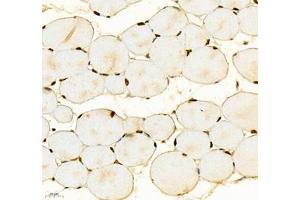 Immunohistochemistry (Paraffin-embedded Sections) (IHC (p)) image for anti-SIX Homeobox 1 (SIX1) antibody (ABIN7075617)