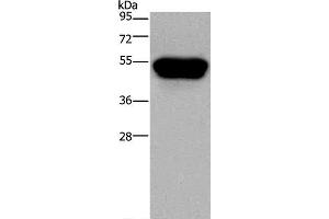 Western Blot analysis of Hela cell using CD160 Polyclonal Antibody at dilution of 1:250 (CD160 抗体)