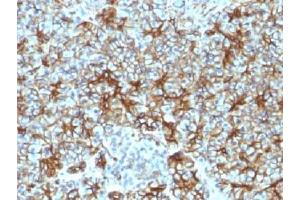 IHC testing of FFPE human pancreas with Spectrin beta III antibody (clone SPTBN2/1583). (Spectrin, Beta, Non-erythrocytic 2 (SPTBN2) (AA 356-475) 抗体)