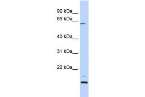 WB Suggested Anti-TCP11L2 Antibody Titration: 0. (TCP11L2 抗体  (N-Term))