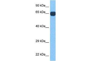 Host:  Rabbit  Target Name:  RFX4  Sample Tissue:  Human Ovary Tumor  Antibody Dilution:  1ug/ml (RFX4 抗体  (N-Term))