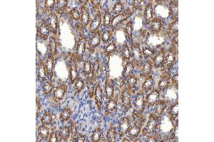 IHC analysis of Mitochondrial Dicarboxylate Carrier/SLC25A10 using anti-Mitochondrial Dicarboxylate Carrier/SLC25A10 antibody (ABIN7601497).