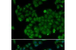 Immunofluorescence analysis of U2OS cells using DNMT3L Polyclonal Antibody (DNMT3L 抗体)
