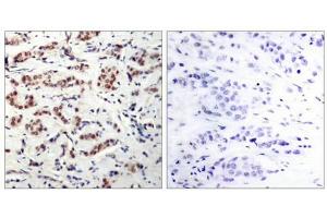 Immunohistochemistry (IHC) image for anti-Signal Transducer and Activator of Transcription 5A (STAT5A) (pTyr694) antibody (ABIN7139047)
