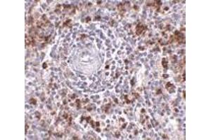 Immunohistochemistry of EBI3 in human spleen tissue with EBI3 antibody at 2. (EBI3 抗体  (C-Term))