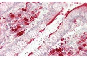 Immunohistochemistry (IHC) image for anti-Angiotensin I Converting Enzyme (Peptidyl-Dipeptidase A) 1 (ACE) (AA 814-1071) antibody (ABIN7430297)