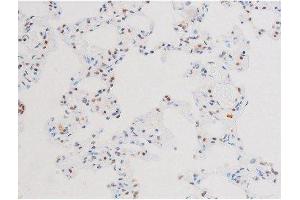 ABIN6267602 at 1/200 staining Rat lung tissue sections by IHC-P. (NF-kB p65 抗体  (pSer281))