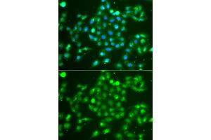 Immunofluorescence analysis of A549 cells using UCHL5 antibody.